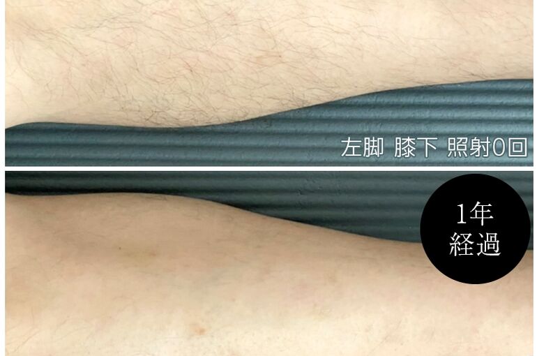 ビフォーアフター２_R
